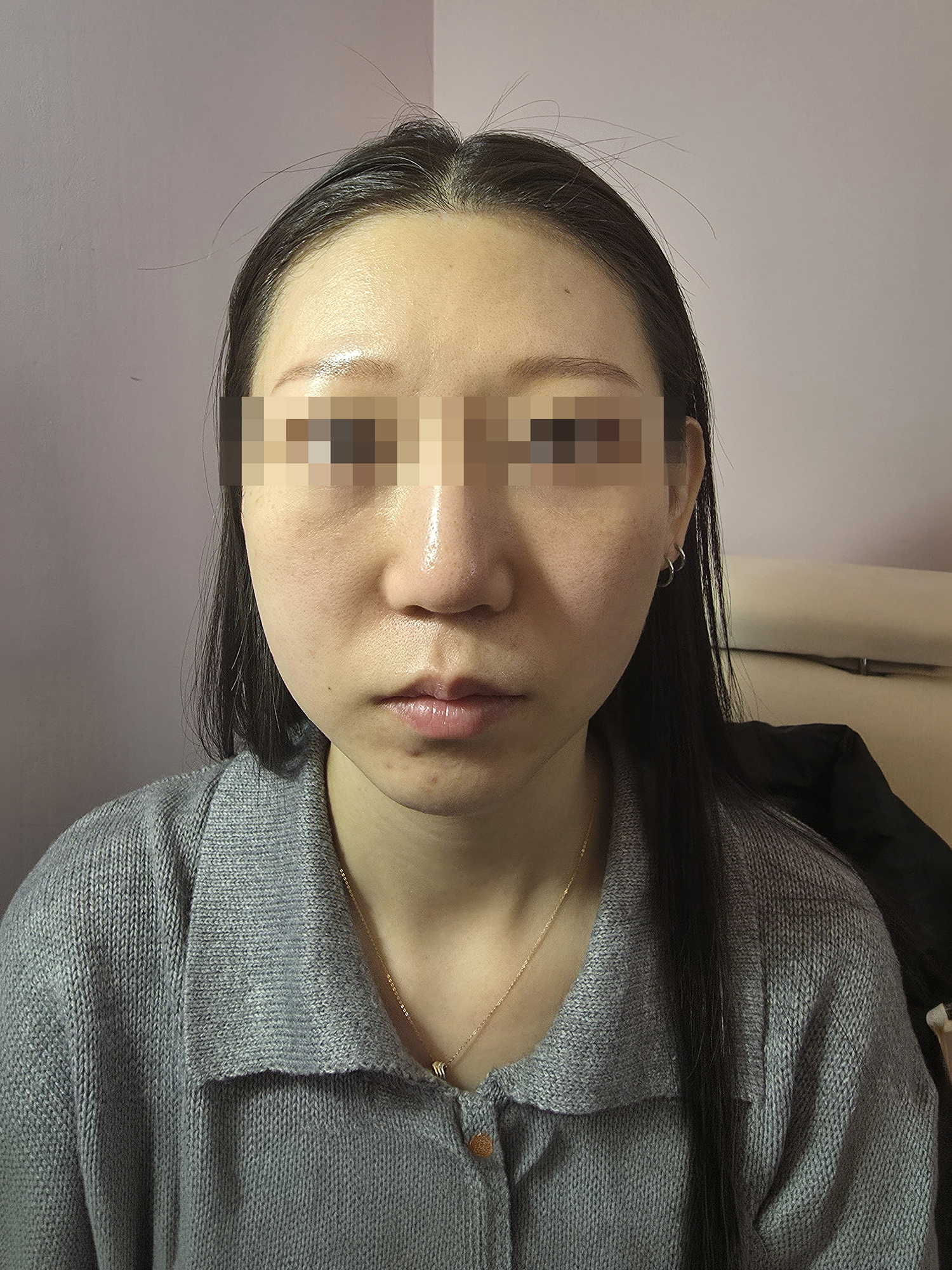 Before